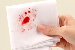 Recetas y métodos efectivos para eliminar la sangre de la ropa en casa.